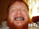 beard-black-teeth.jpg